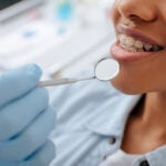 cropped view of orthodontist in latex glove holding dental mirror near happy patient in braces